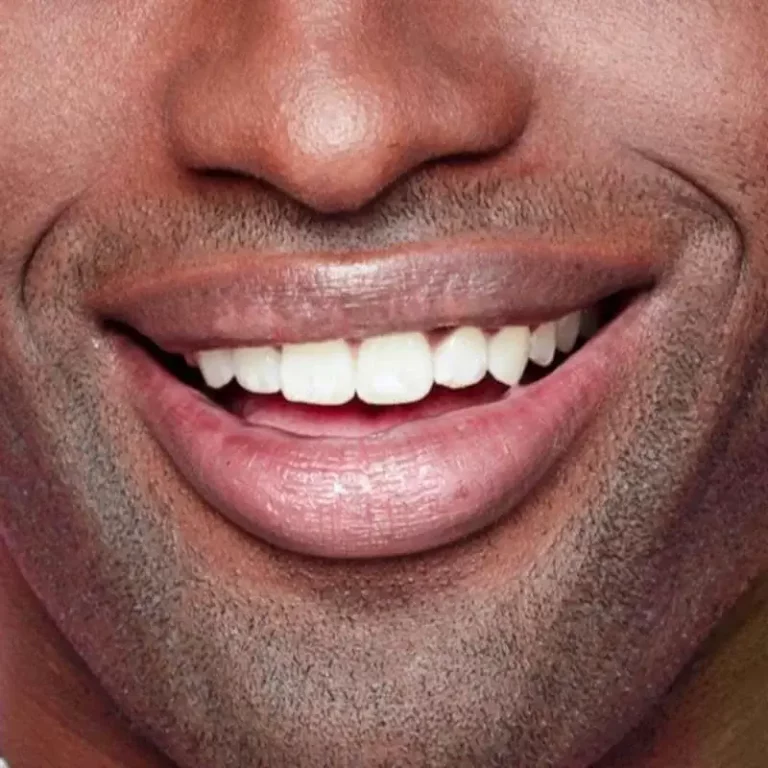 an image of a man smiling with his smile makeover