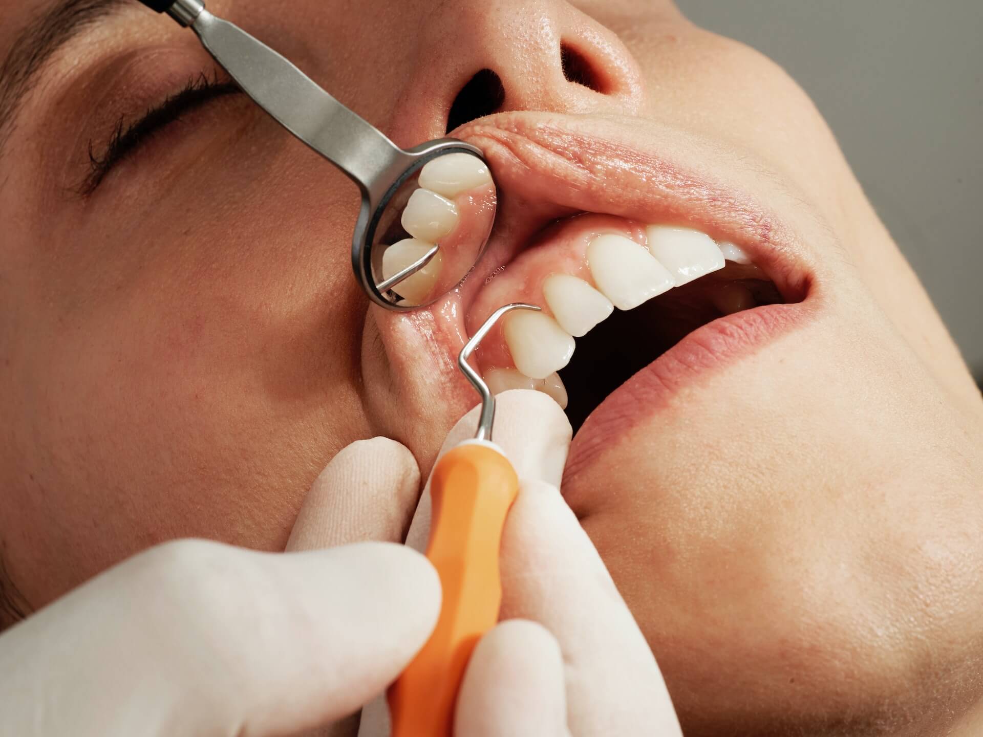 a patient having his teeth cleaned professionally