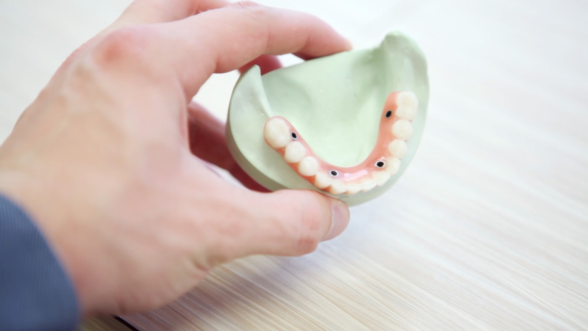 an image of a mould showcasing are composite fillings better than amalgam