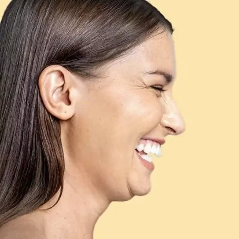 an image of a girl with contoured gums