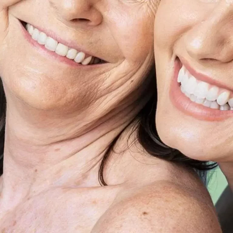 an image of a mum and daughter smiling after their cosmetic denture treatment