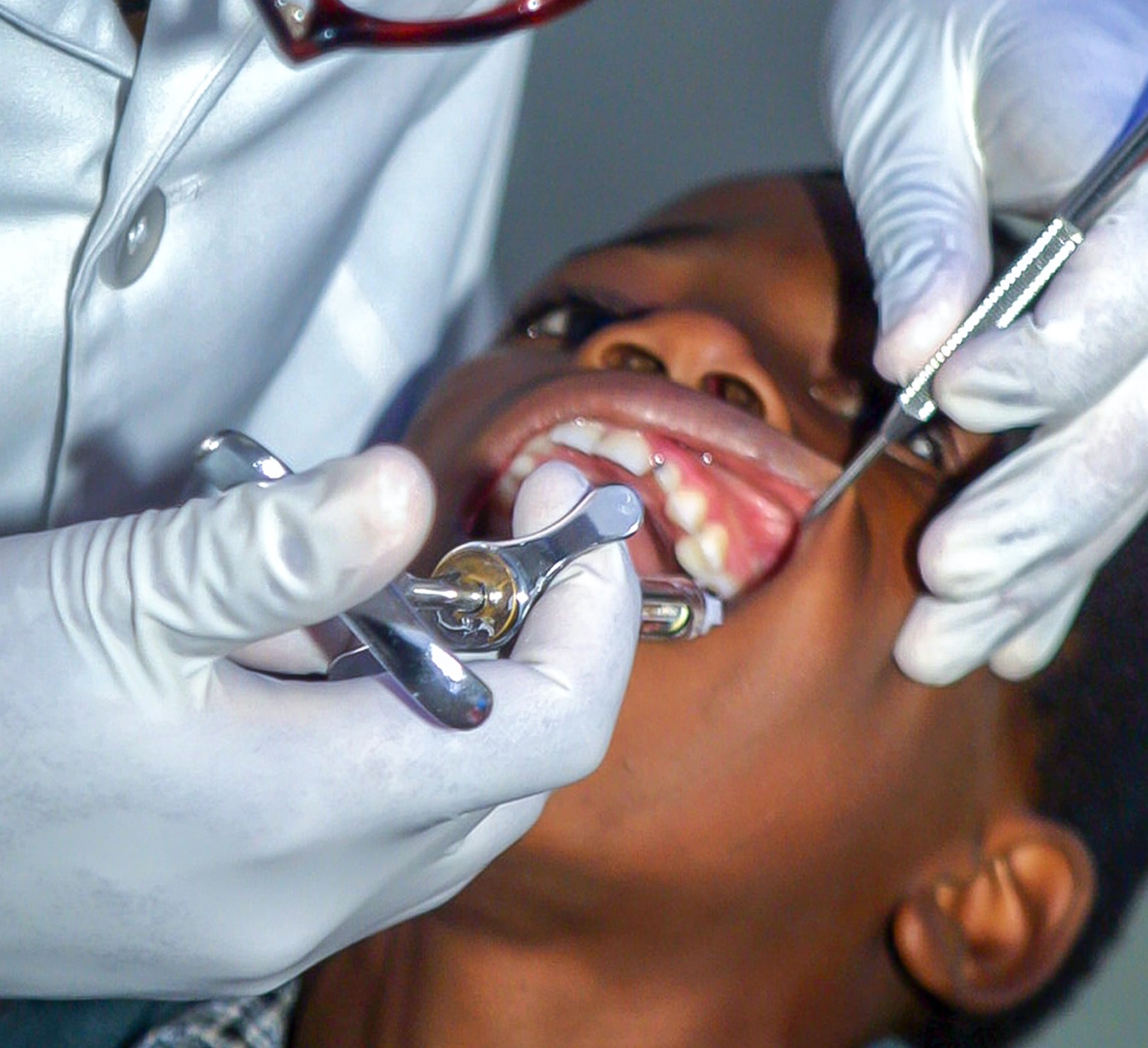 an image of a boy having treatment after discovering what are composite fillings